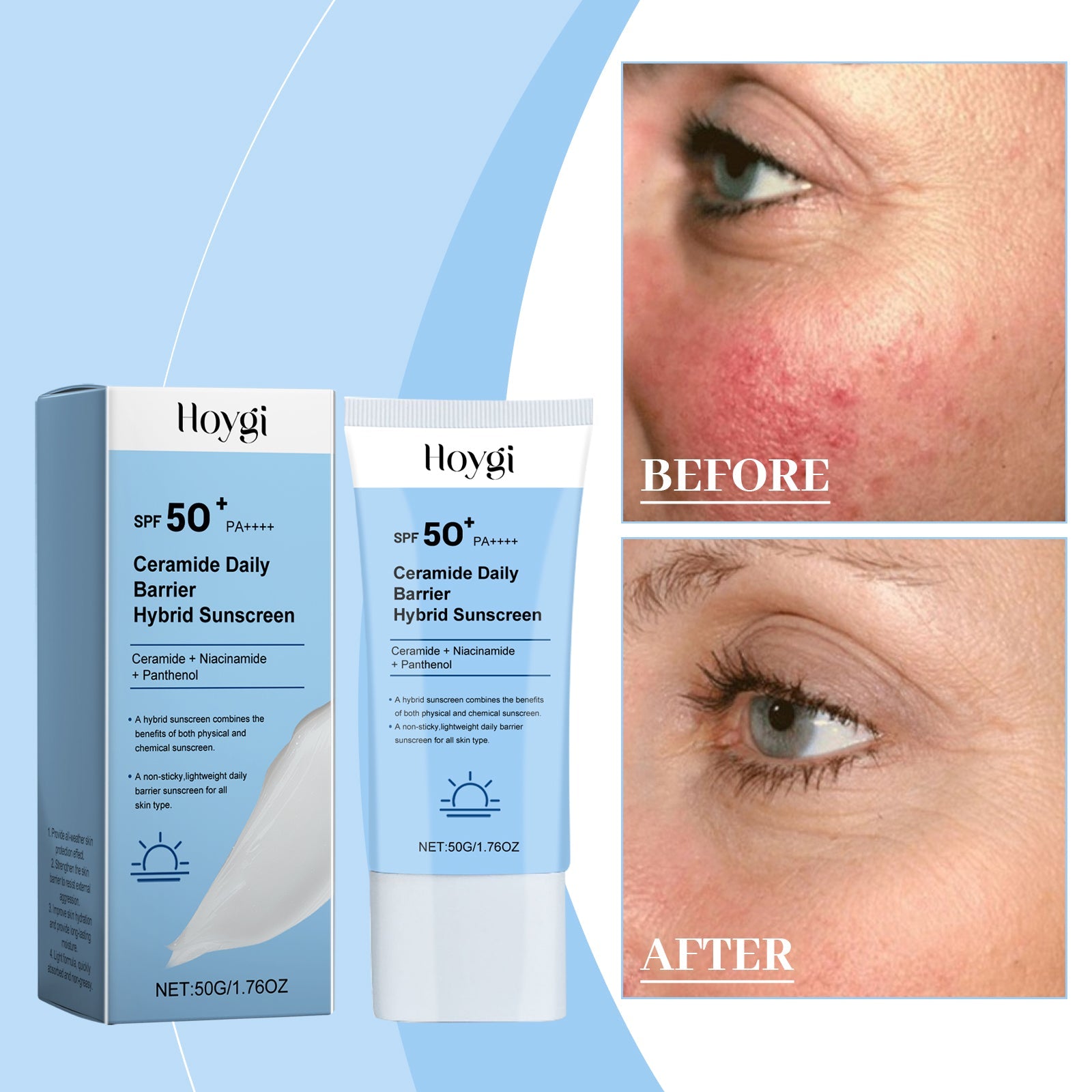 Ceramide Protective Cream, Refreshing And Moisturizing In Summer, Protects Skin, Restores Uv Isolation And Prevents Sweat - Korvel
