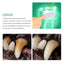 Manchons de nettoyage des dents pour animaux de compagnie