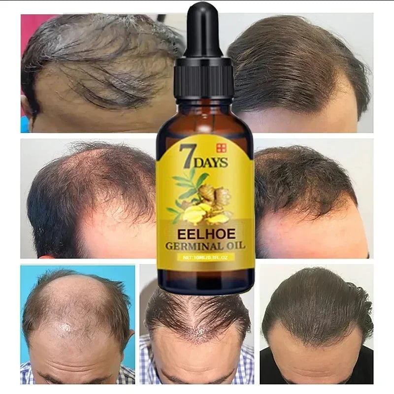 7 Day Fast Hair Growth Oil Ginger Growth Hair Treatment Anti Hair Loss Men Women Scalp Treatment Serum Products Beauty Product - Korvel