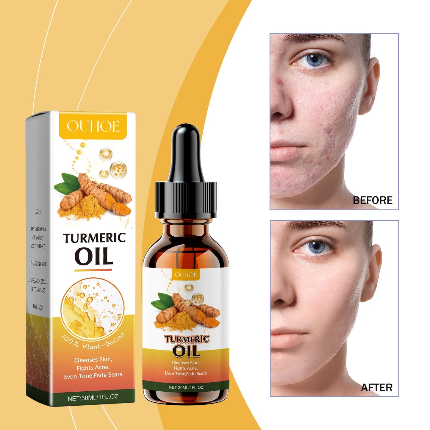 Ouhoe Cleansing Turmeric Oil for Radiant Skin