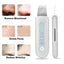 HailiCare Ultrasonic Peeling Machine for Skin Cleansing