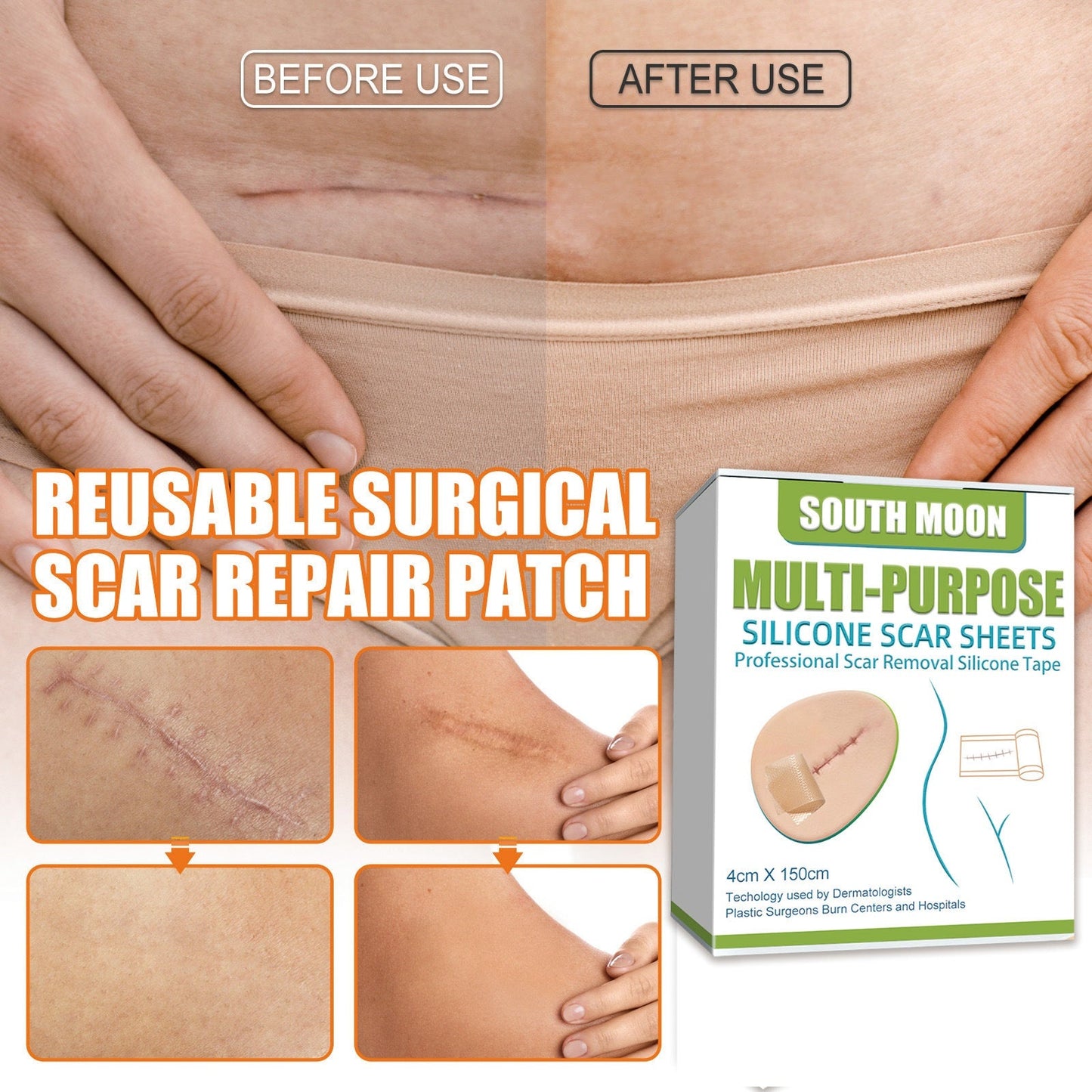 Skin Care Patch for Reducing Skin Imperfections with Gentle Ingredients for Daily Use - Korvel