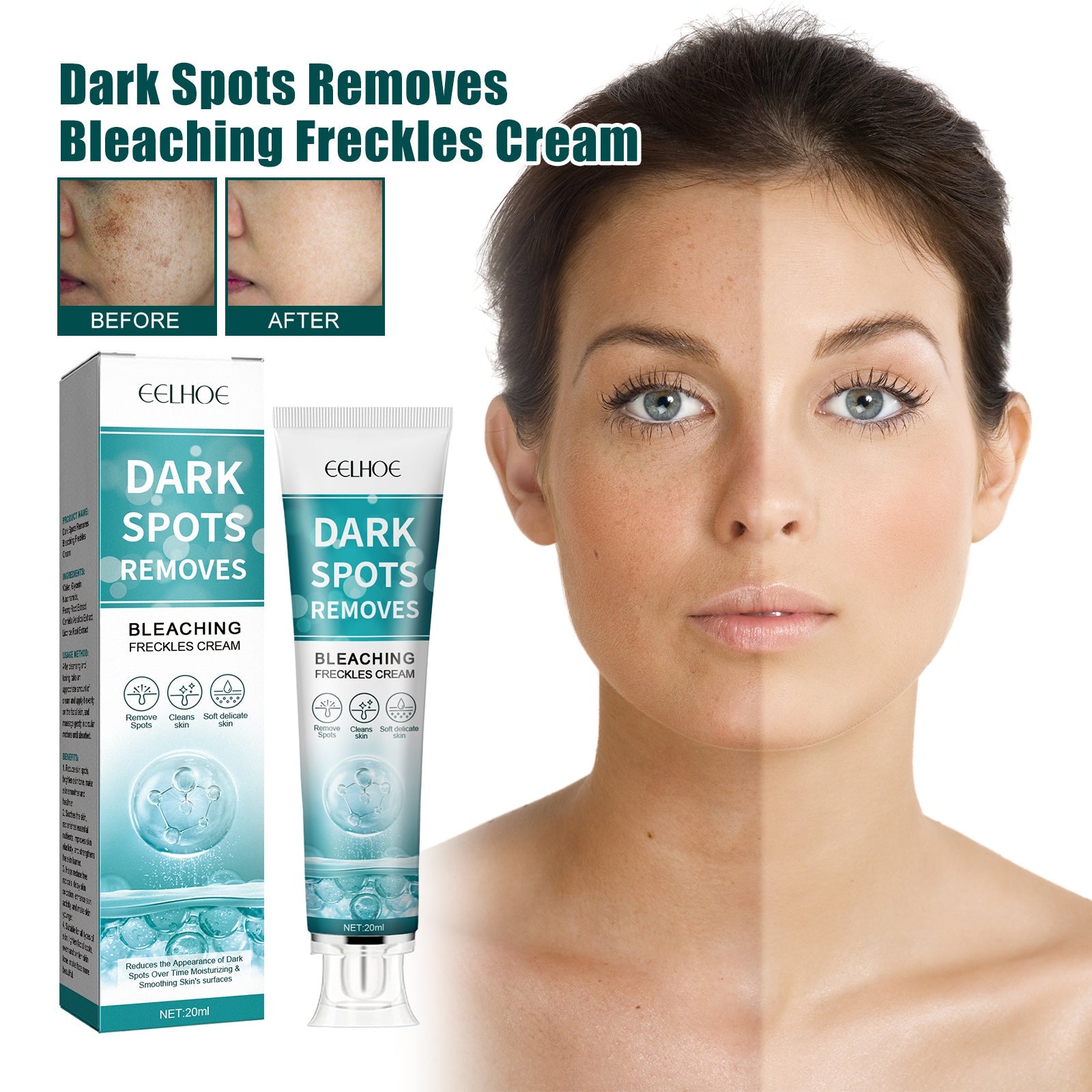 Whitening Spot Cream Hydrates And Moisturizes Skin To Lighten Spots, Acne Whitening, Brightening And Rejuvenating Skin Beauty Cream - Korvel