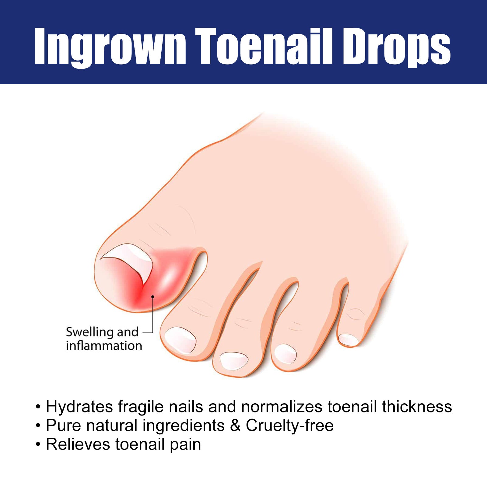 Nail Repair Solution Gentle Clean, Moisturize, Moisturize And Nourish Nails And Nails - Korvel