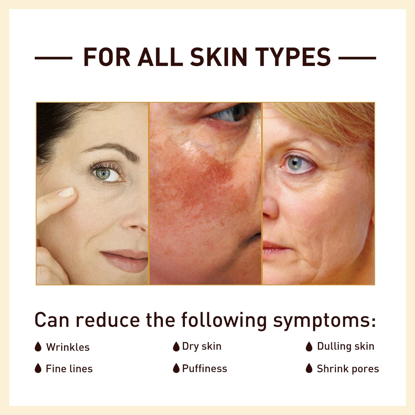 Rice Anti Wrinkle Essence, Repairs Skin Moisturizes Firms Whitens Essence - Korvel