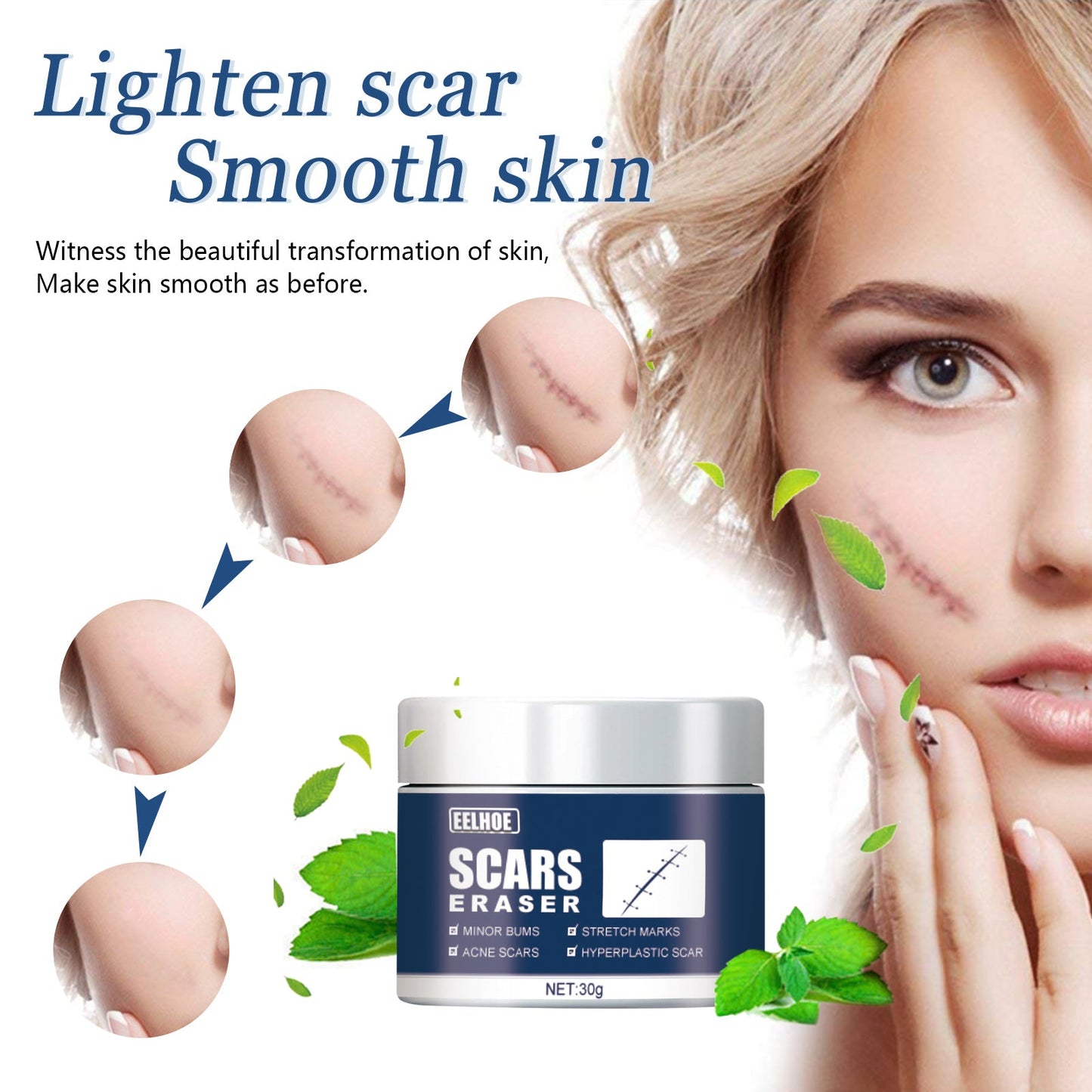 Scar Balm, Surgery Scar Repair Cold Compress Scar Skin Scar Gel Balm - Korvel