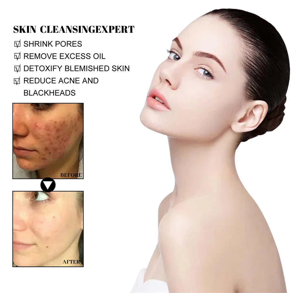West & Month Blackhead Remove Solid Mud Film Refreshing Skin Cleaning Face Mask Moisturize Control Oil Shrink Pores Skin Care - Korvel