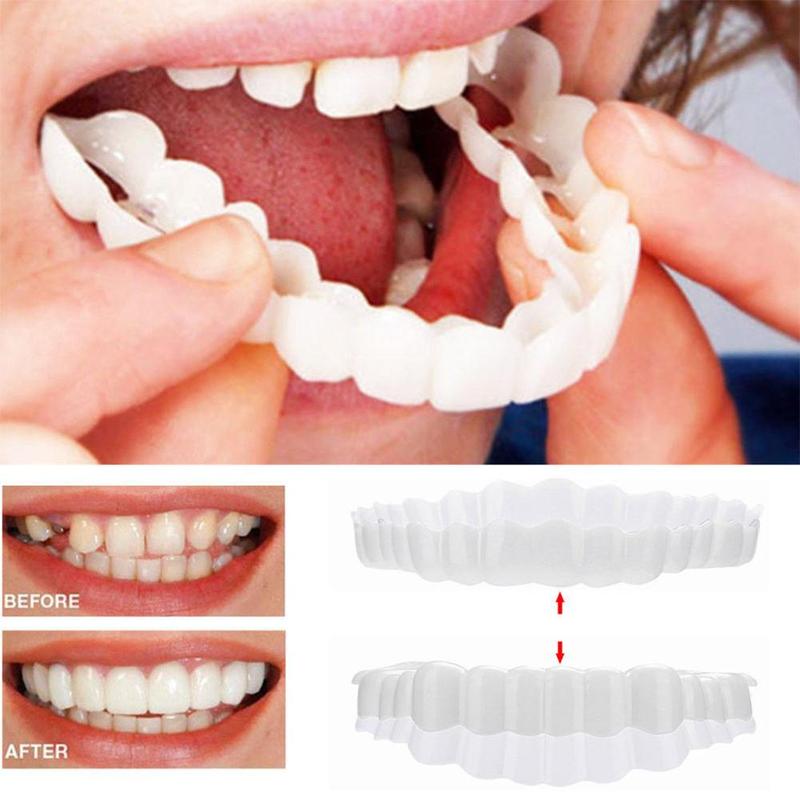 Snap On Smile Teeth Veneers - Instant Cosmetic Enhancement