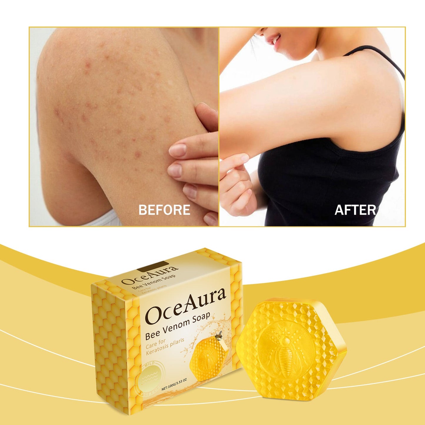 Oceaura Bee Venom Soap For Deep Body Cleansing, Moisturizing, Brightening And Improving Skin And Bathing Body Soap - Korvel