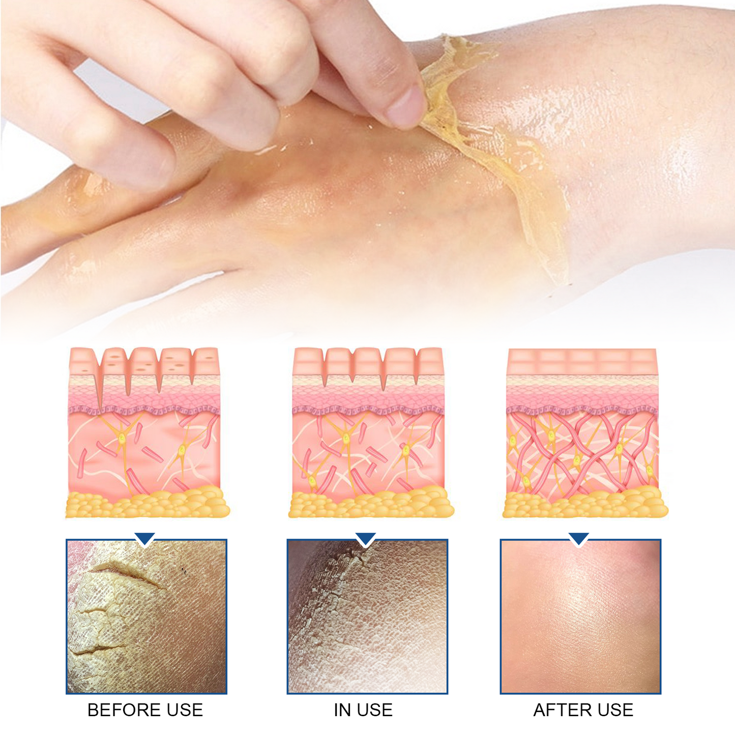 Exfoliating Hand Mask Moisturizes And Moisturizes Tender Skin, Alleviates Dry, Rough And Chapped Hands - Korvel