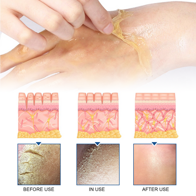 Exfoliating Hand Mask Moisturizes And Moisturizes Tender Skin, Alleviates Dry, Rough And Chapped Hands - Korvel
