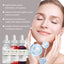 Acne Set Facial Cleansing Acne Repair Skin Whitening Acne Print Essence Mask Set - Korvel
