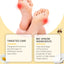 Bee Venom Care Cream, Bee Venom Care Cream To Relieve Inflammation, Pain Swelling Can Improve Joint Health Bunions Adjuvant Therapy - Korvel