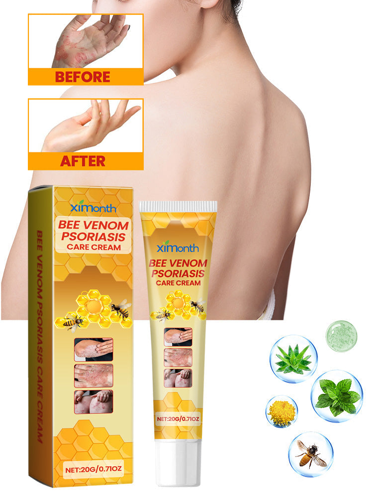 Crema de Musgo de Piel de Vaca con Veneno de Abeja Premium para la Comodidad de la Piel