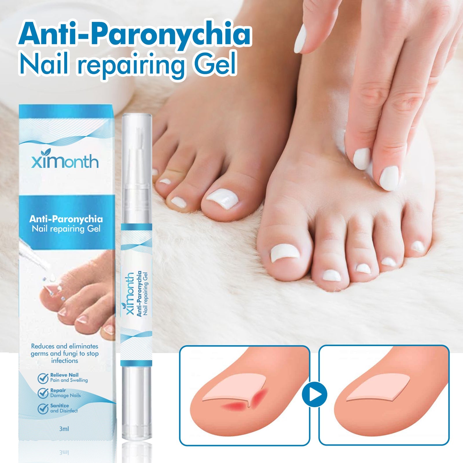 Anti-Paronychia Nail Repairing Gel, Repair Encased Rotten Nails Soft Nails Thickening Pain Relief Cleansing Care - Korvel