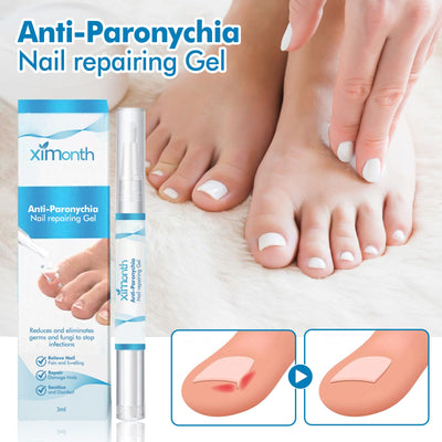Anti-Paronychia Nail Repairing Gel, Repair Encased Rotten Nails Soft Nails Thickening Pain Relief Cleansing Care - Korvel