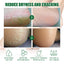 Chapped Heel Care Cream Repair Heel Peeling, Anti-Cracking And Moisturizing Foot Care Cream - Korvel