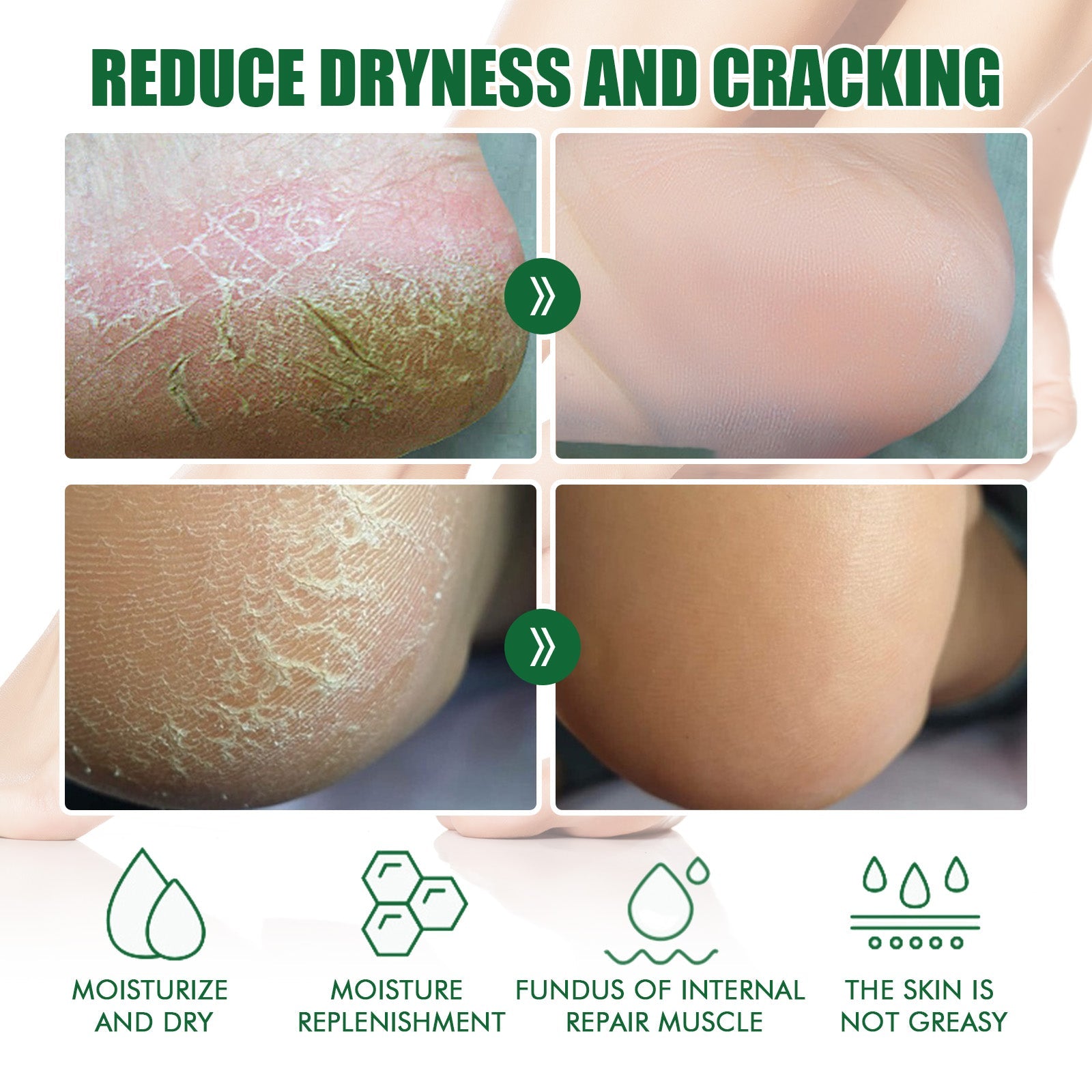 Chapped Heel Care Cream Repair Heel Peeling, Anti-Cracking And Moisturizing Foot Care Cream - Korvel