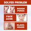 Sérum Réducteur de Pores pour une Texture de Peau Affinée