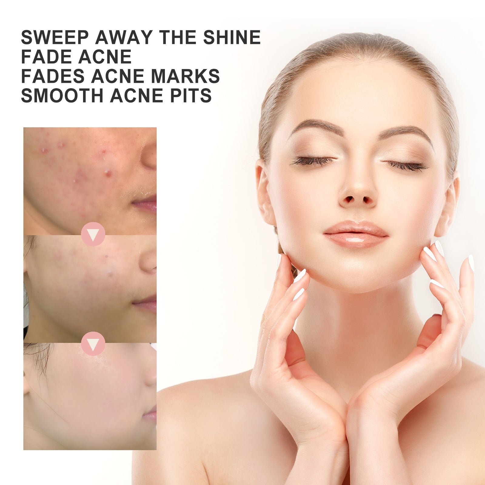 Acne Patch, Repair Acne Pimple Facial Redness Clean Pores Moisturize Skin Patch - Korvel