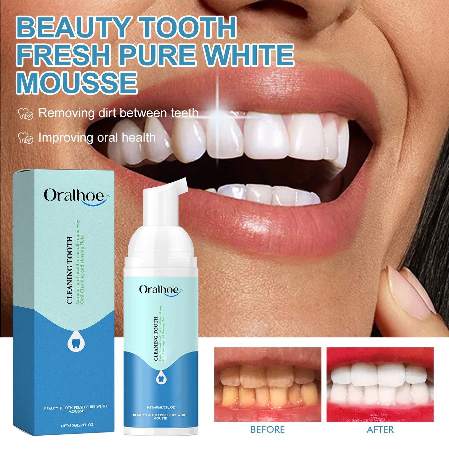 Pure White Mousse Toothpaste for Bright Smiles