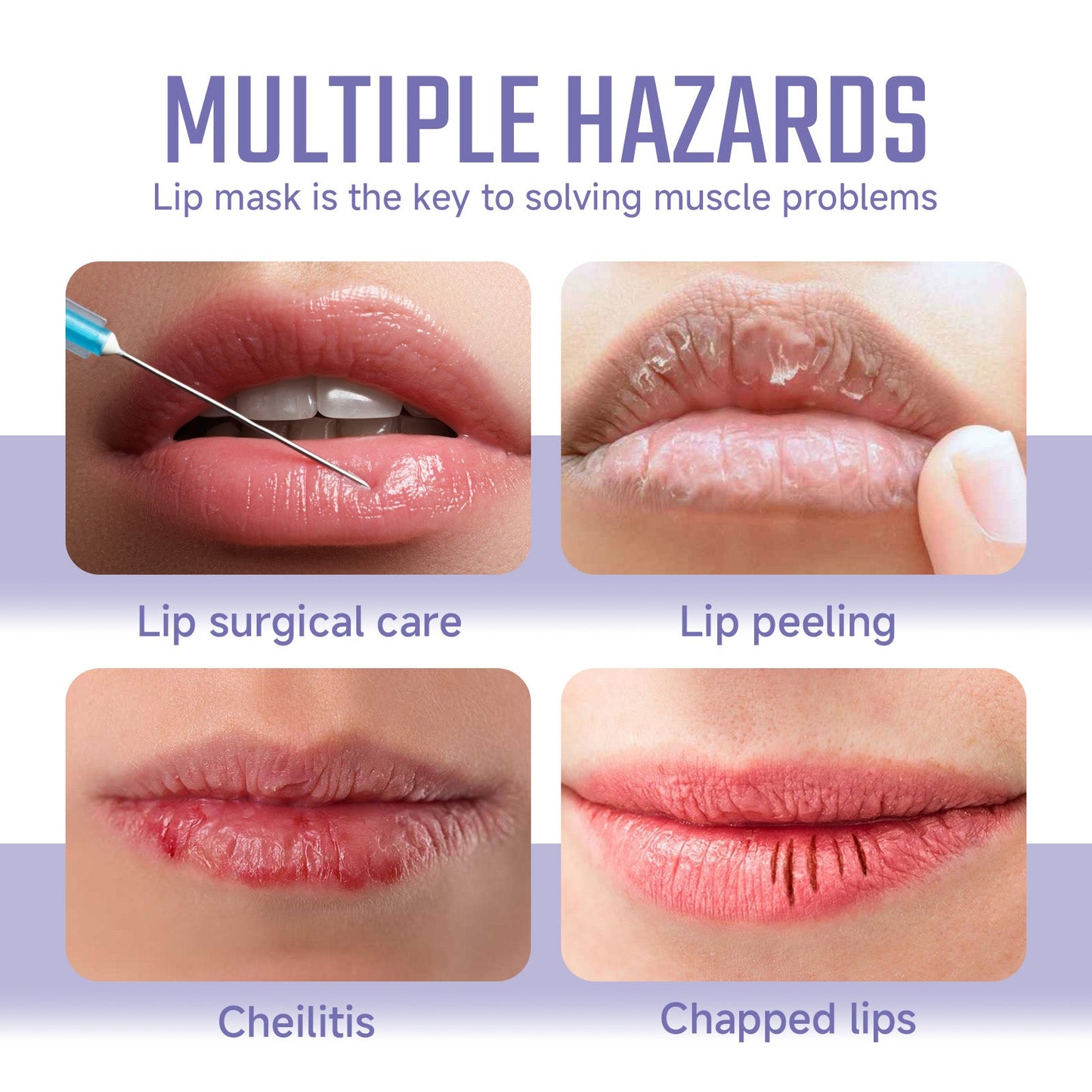 Ouhoe Collagen Lip Mask Repair Lip Lines, Remove Dead Skin, Prevent Dry And Crack, Moisturize And Care Lip Mask - Korvel