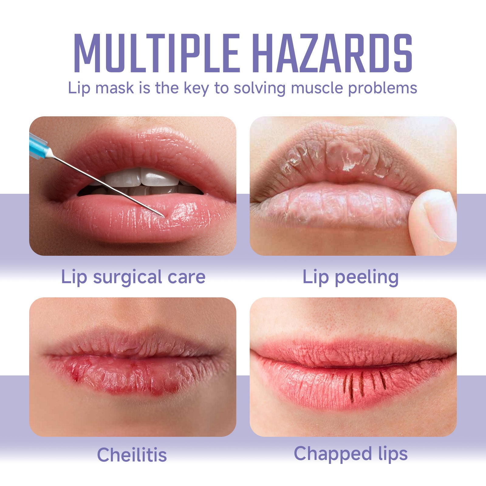 Ouhoe Collagen Lip Mask Repair Lip Lines, Remove Dead Skin, Prevent Dry And Crack, Moisturize And Care Lip Mask - Korvel