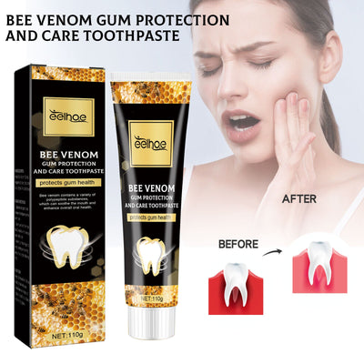 Bee Venom Gingival Toothpaste, Cleaning Stains Breath Fresh Whitening Toothpaste - Korvel