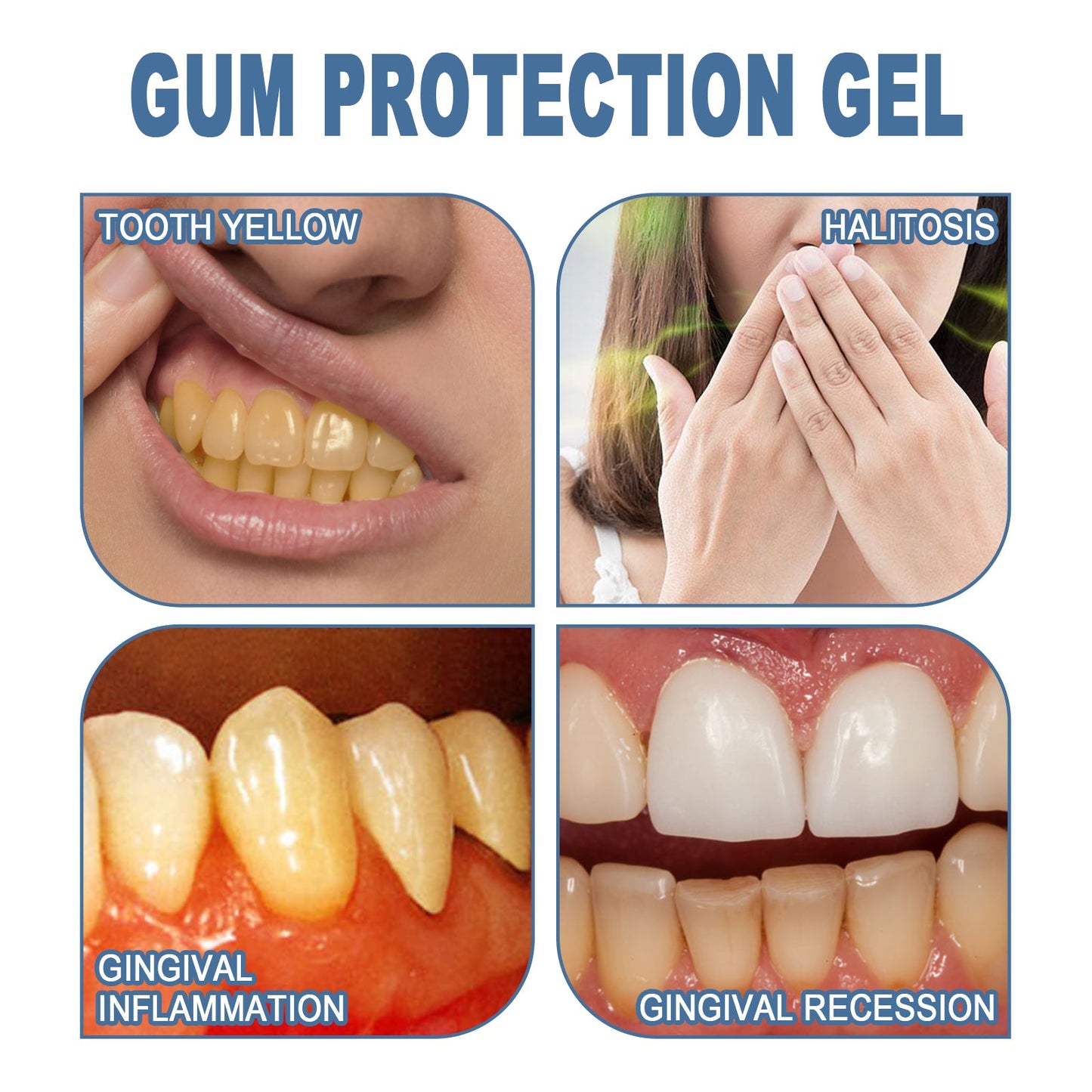 Gum Protection Gel, Teeth Whitening And Whitening Gum Repair Oral Cleaning And Care Dental Pencil - Korvel