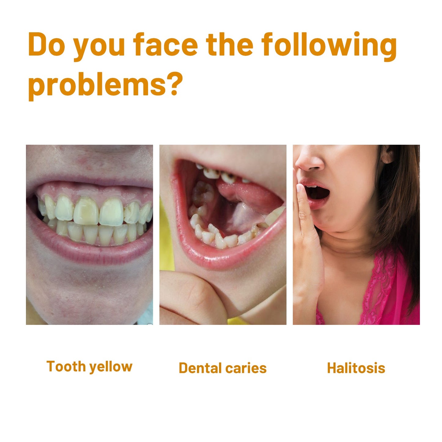 Premium Tooth Whitening Mousse for Bright, Fresh Smile