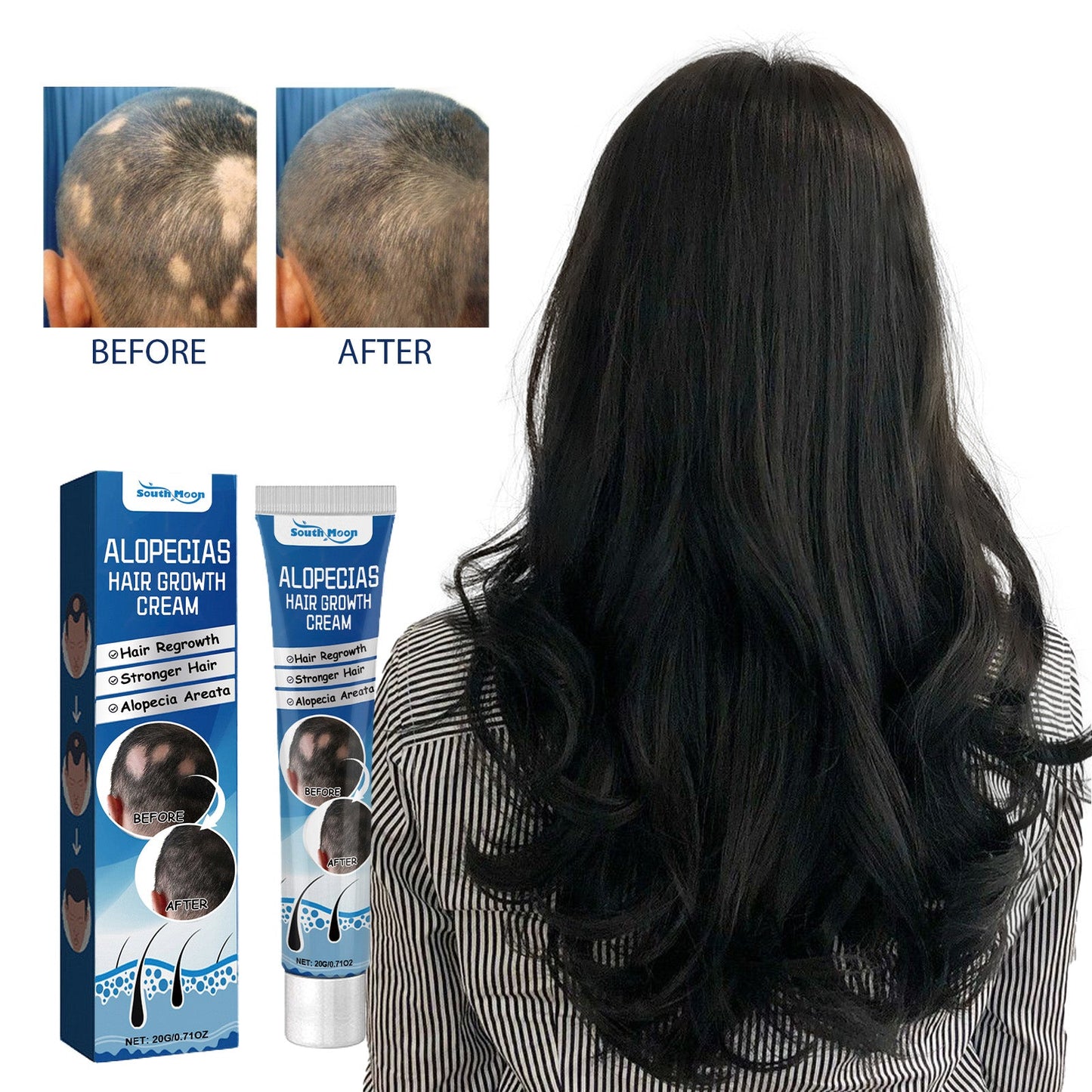 Alopecias Hair Growth Cream, Protect Hair Follicles Strong Moisturizing Thick Hairline Hair - Korvel