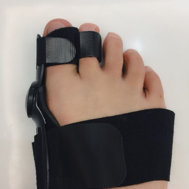 Day And Night Use Of Hallux Valgus Orthosis Thumb Valgus Orthosis Toe Orthosis - Korvel