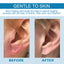 Gotas de Cuidado Premium para Piercings para el Mantenimiento de Piercings en las Orejas