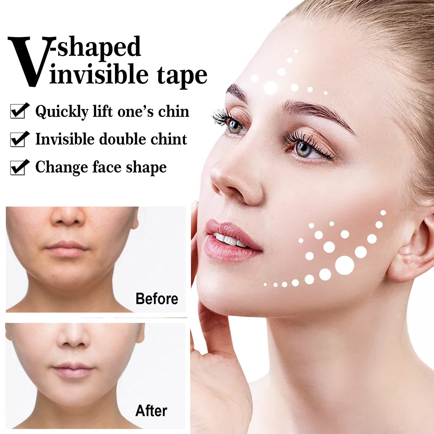 Invisible Lifting Patch for a Defined V-Face