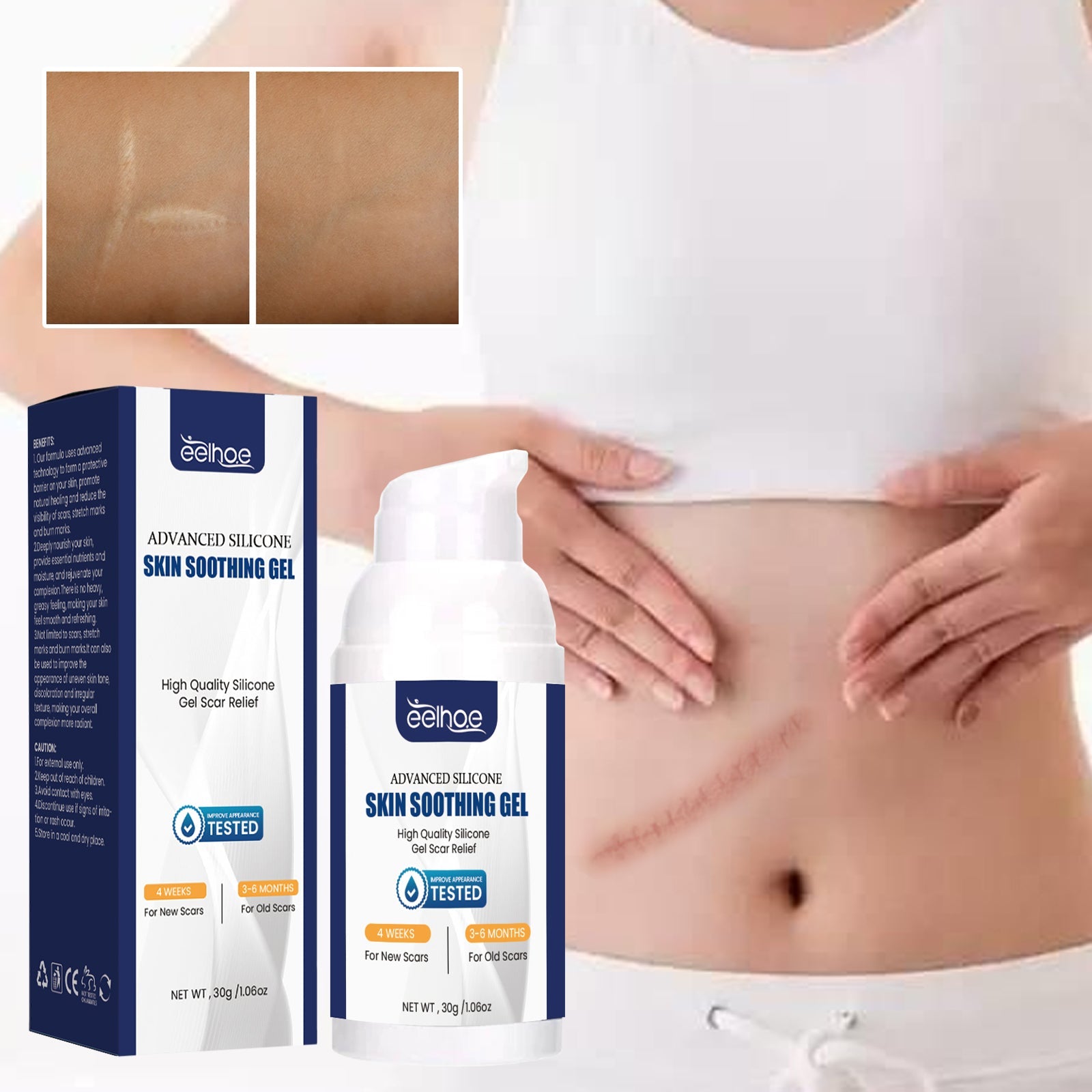 Scar Gel, Fade Skin Scar Pregnancy Surgery Scar Moisturizing Skin Care Gel - Korvel