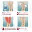 Intravenous Massage Spray For Varicose Veins Relief And Earthworm Leg Blood Vessel Bulge Pain Spray - Korvel