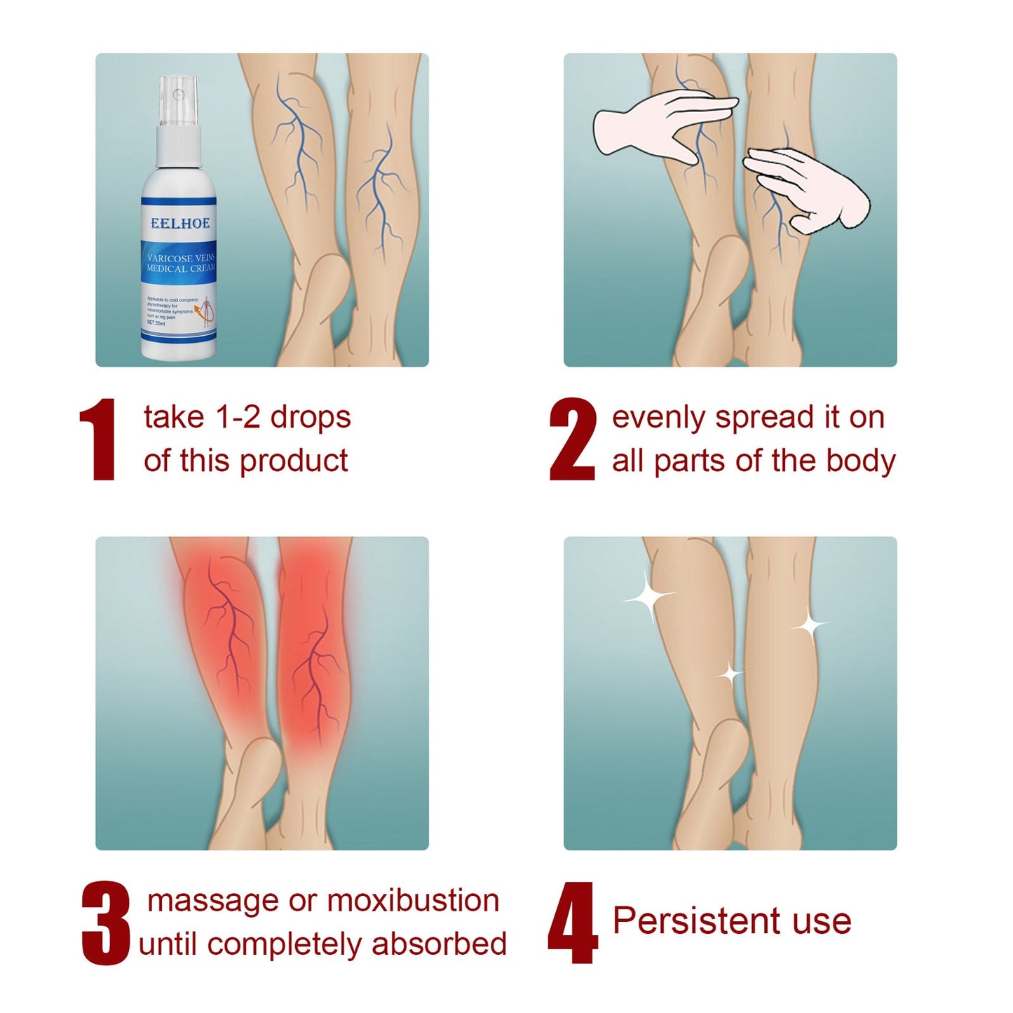 Intravenous Massage Spray For Varicose Veins Relief And Earthworm Leg Blood Vessel Bulge Pain Spray - Korvel