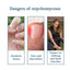 Traitement Premium pour les Ongles Sains