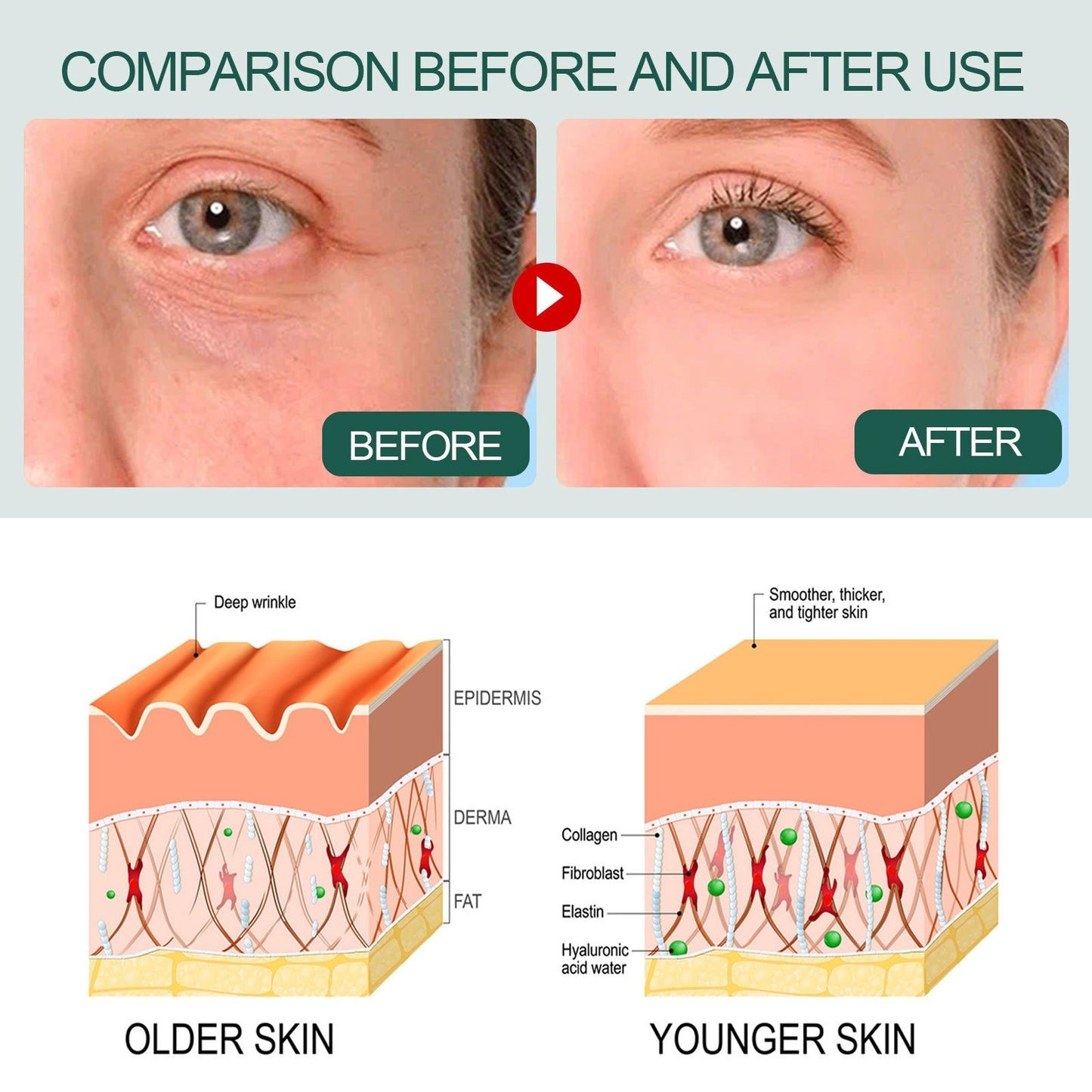 OUHOE Essence collagen replenishing essence whitening freckle removal facial essence brightening hydrating moisturizing - Korvel
