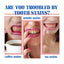 Probiotic Brightening Toothpaste, Oral Cleaning Remove Odor Stains White Teeth Gum Care Toothpaste - Korvel