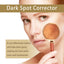 Dark Spot Corrector, Moisturizing And Gently Lightening Uneven Skin Tone Repair Dull Apply Cream - Korvel