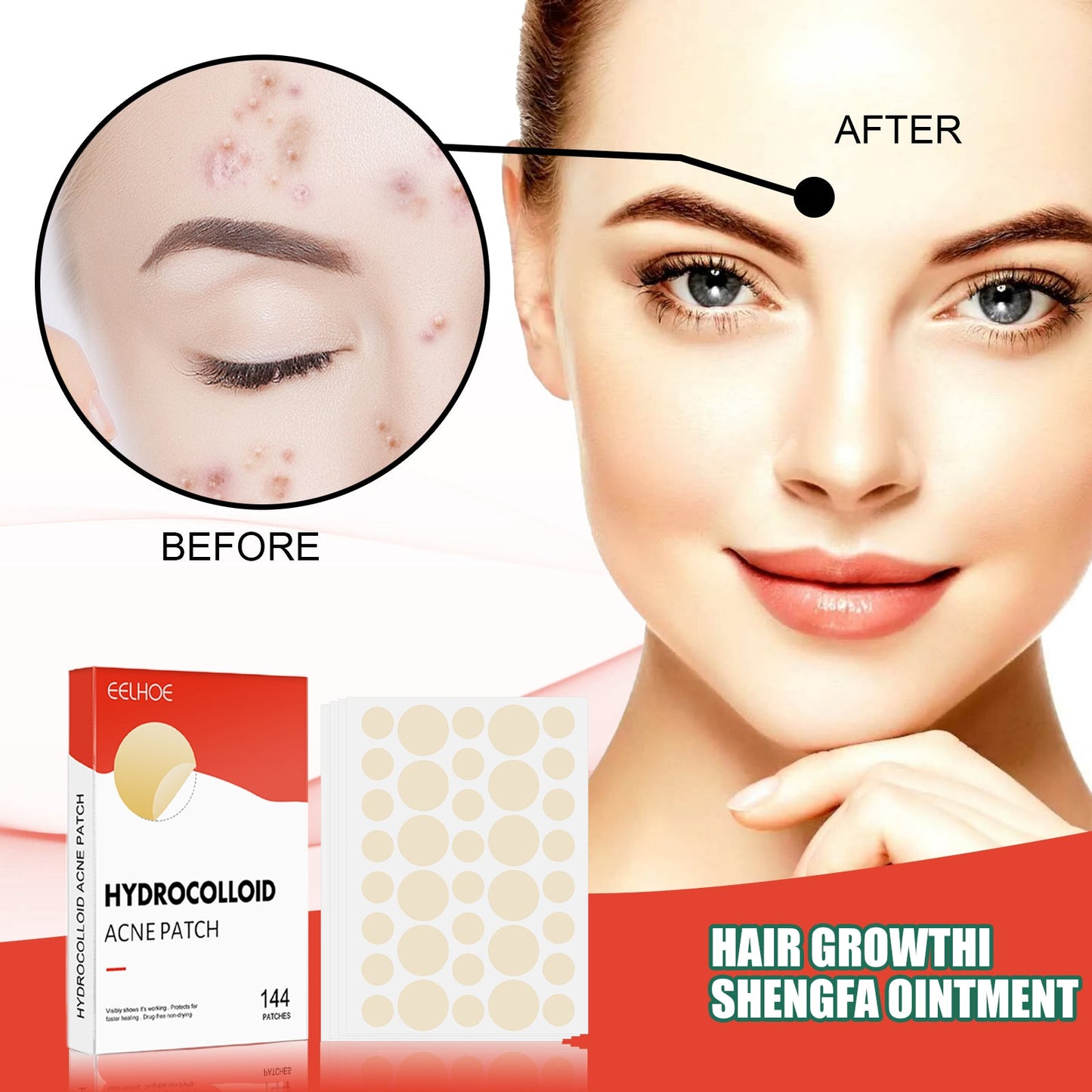 Invisible Hydrocolloid Acne Patches for Clear Skin