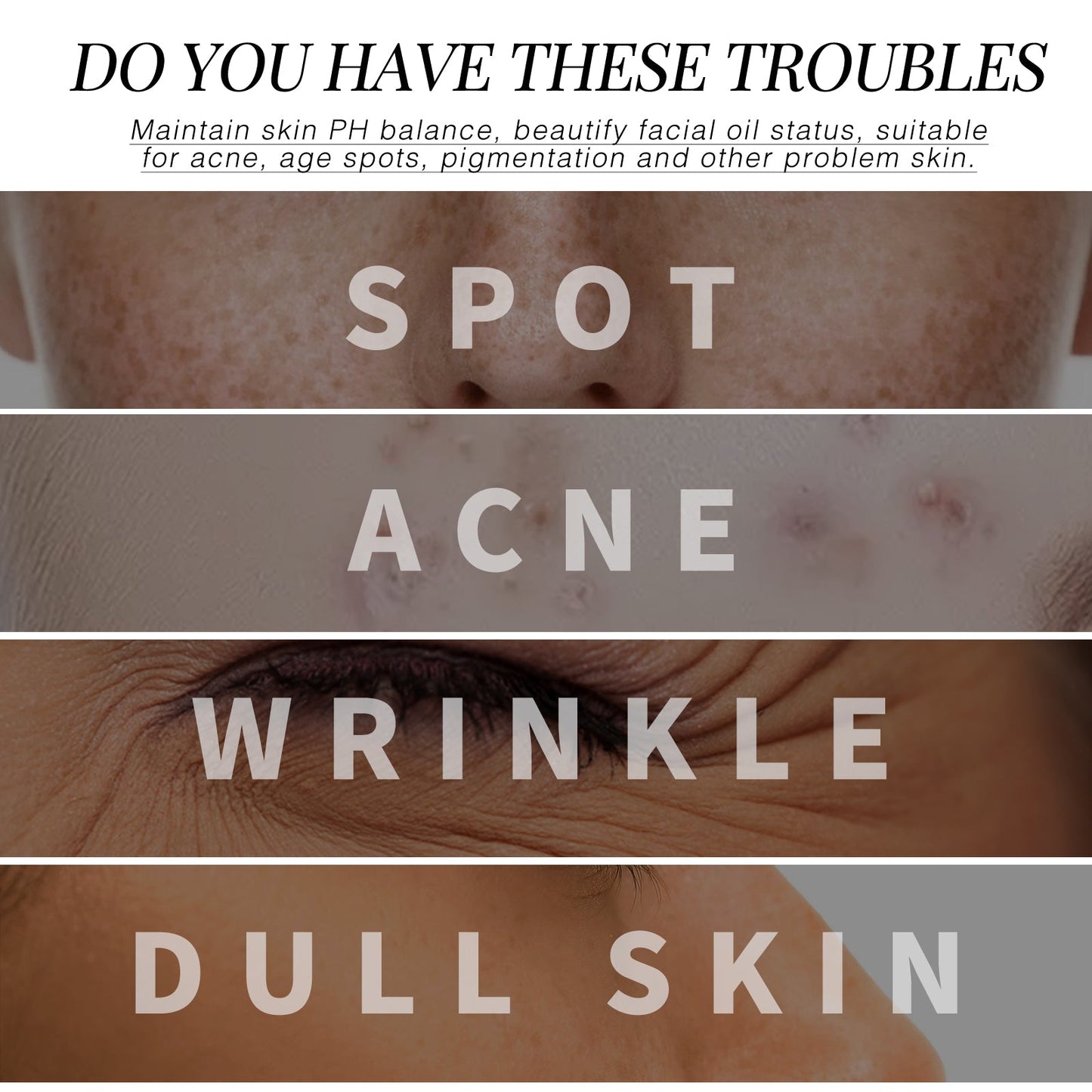 Dark Spot Repair Essence, Repair Acne Pimple Lightening Spot Fine Lines Moisturizing Firming Whitening Essence - Korvel