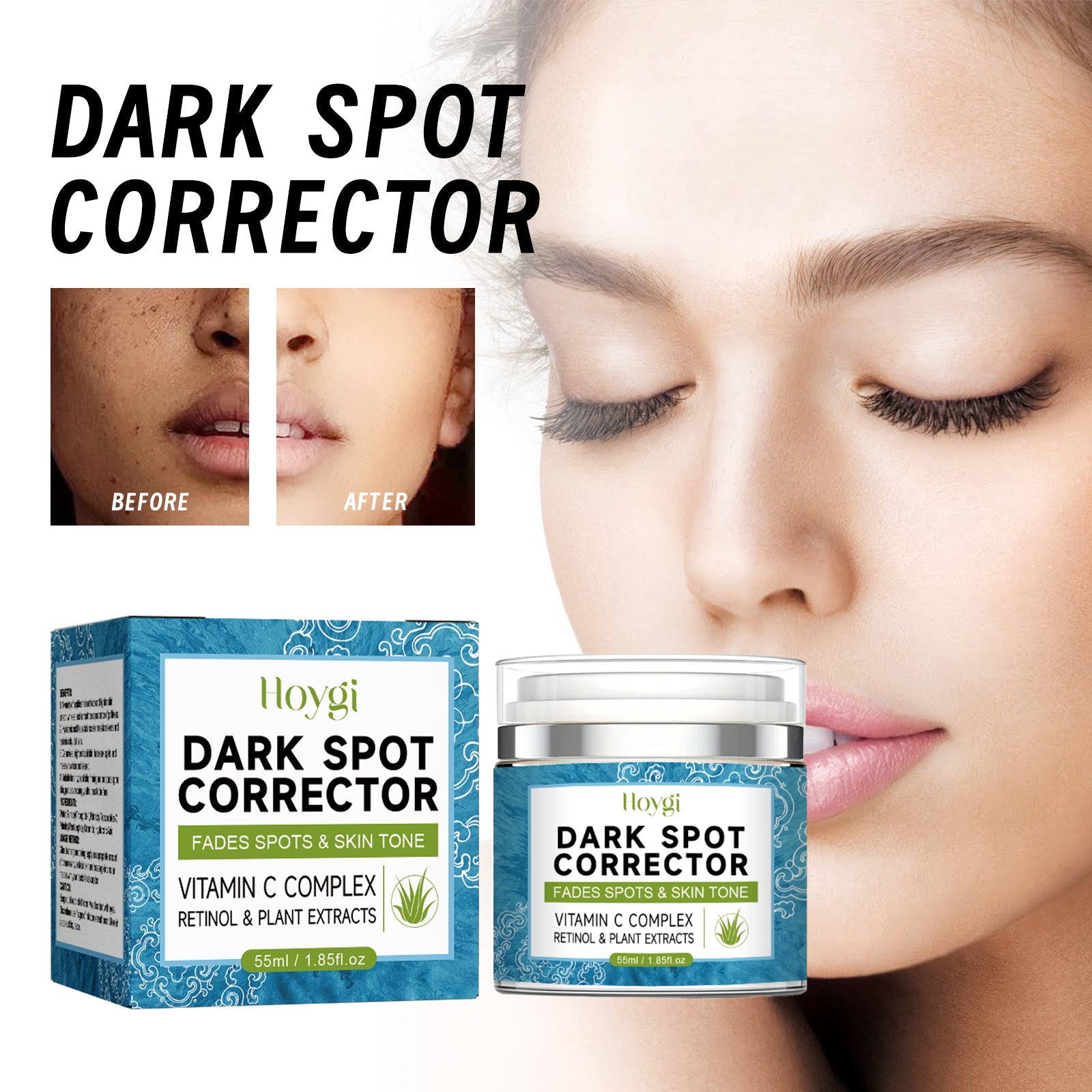 Dark Spot Lightening Cream Lightening Dark Spot Melasma Repairing Dull And Even Skin Tone Brightening Cream - Korvel