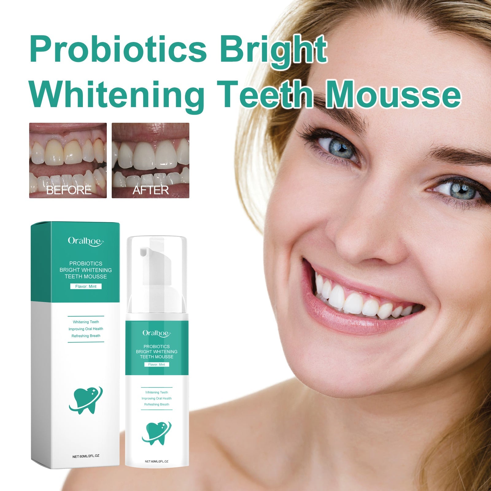 Probiotics Bright Whitening Teeth Mousse, Clean Mouth Odor Tartar Very Well To Protect The Gum Beautiful White Teeth - Korvel