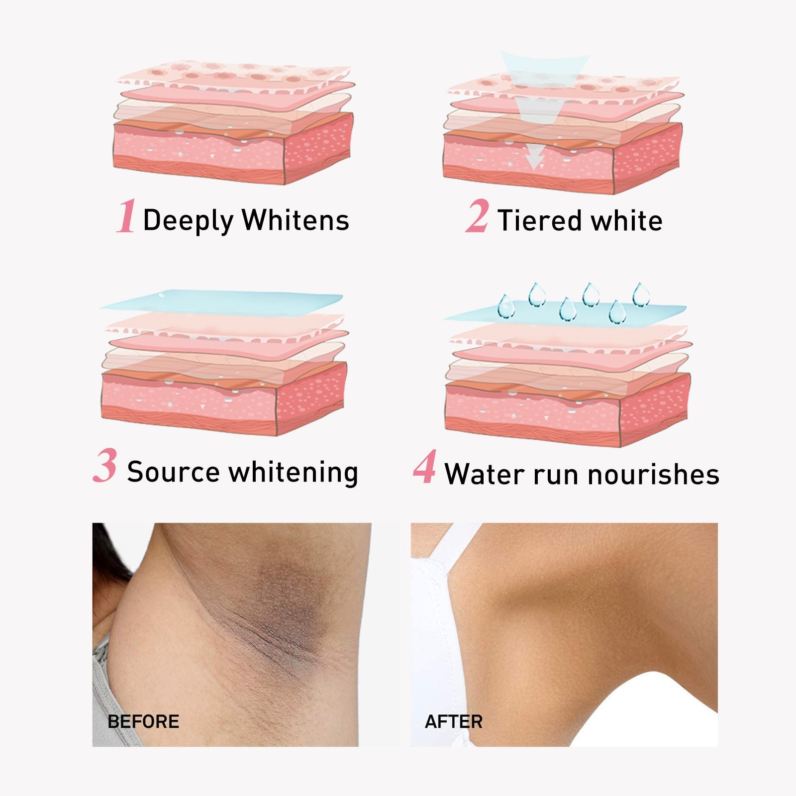 Niacinamide Intimate Areas Tightening Cream, Fade Dark Skin Even Skin Tone Beauty Skin Whiten Cream - Korvel