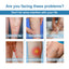 Spray Premium para el Tratamiento de Venas en las Piernas para Comodidad y Cuidado