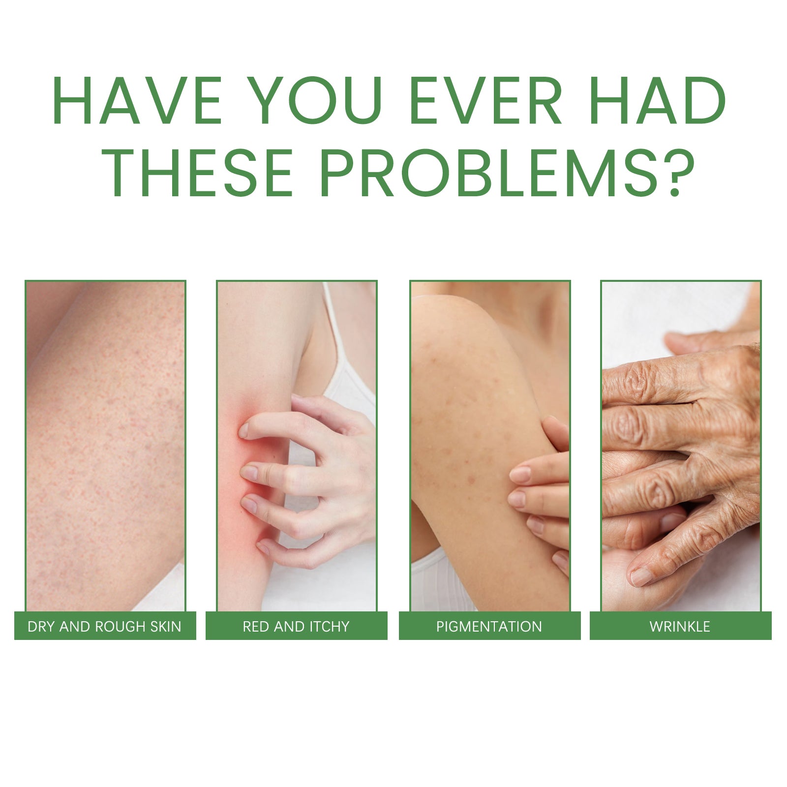Firming Collagen Body Cream Moisturizes And Repairs Chicken Skin, Prevents Dry, Tender And Smooth Skin, Brightening And Beautifying Skin - Korvel