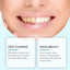 Gentle Braces Cleansing Mousse for Fresh Mouth