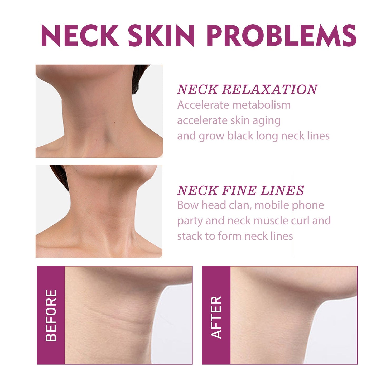 Hydrolyzed Collagen Neck Cream, Fade Neck Lines Shaping Swan Neck Smooth White Neck Cream - Korvel